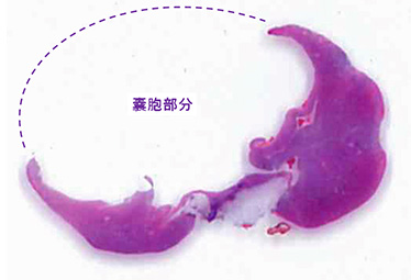 副腎疾患2か月後