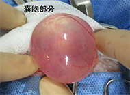 ハリネズミの水腎症